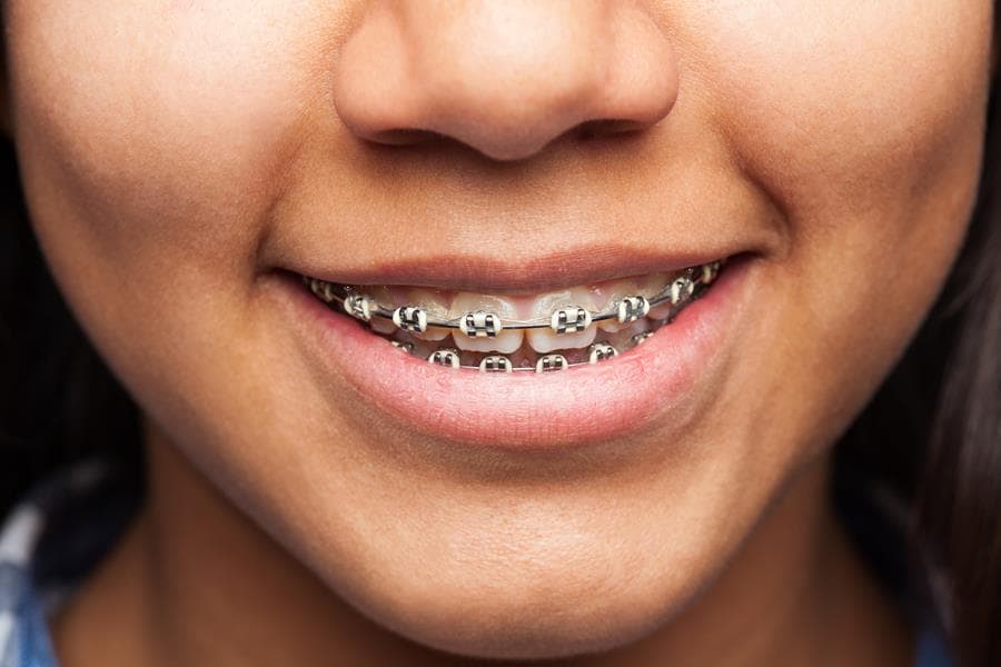 Orthodontics